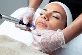 FORMATION  MICRONEEDLING / HAIR NEEDLING / BB GLOW