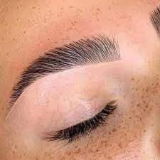 FORMATION BROW LIFT