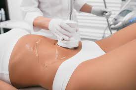 FORMATION LIPOCAVITATION / RADIOFREQUENCE